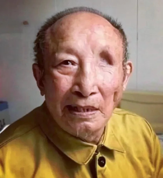 抗美援朝老兵刘希枝，在朝鲜战场上被地雷炸伤，左眼失明，头部残留7块弹片，伴随老人