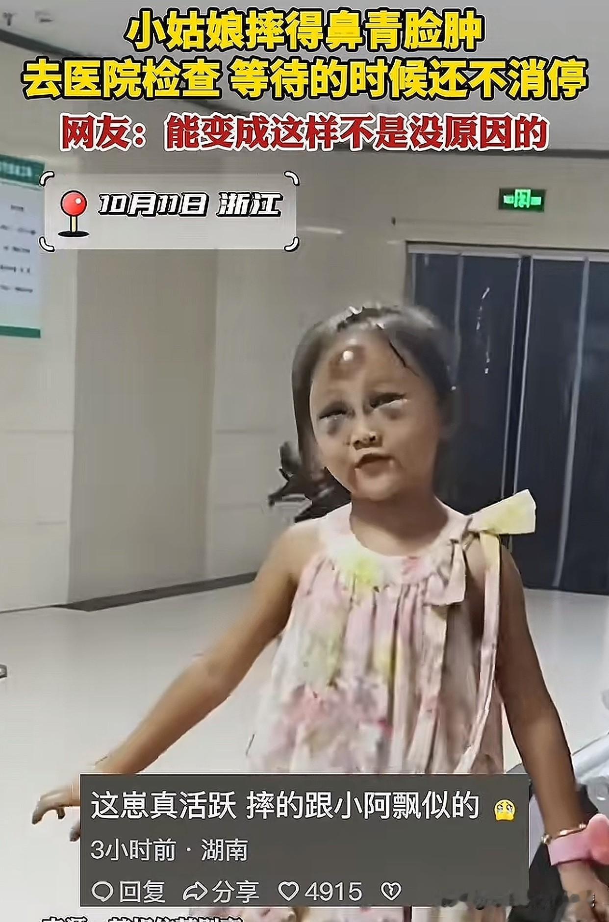 “真是哭笑不得啊！”浙江一小女孩摔得脸上青一块紫一块的，在医院等着看病时却一点不