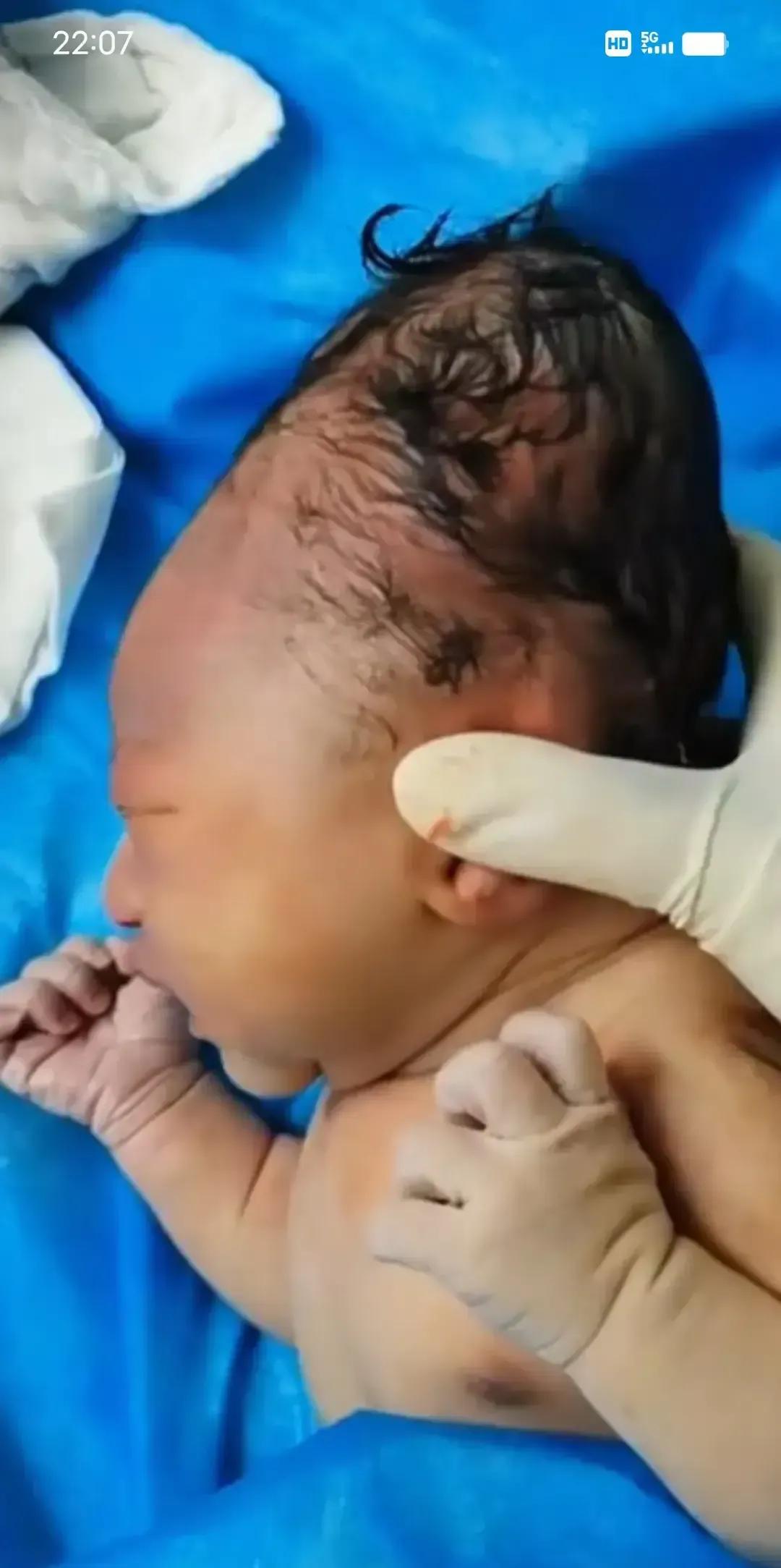 刷到一条视频，说产妇想剖，丈夫嫌贵硬让顺，结果娃脑袋挤变形，老公当场哭。画面看