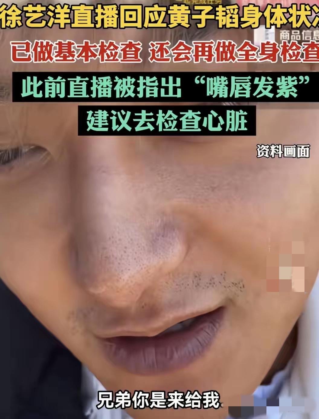黄子韬嘴唇紫的可怕，让一众网友担心不已，纷纷让他去查心脏。他嘴唇的模样像极了刚