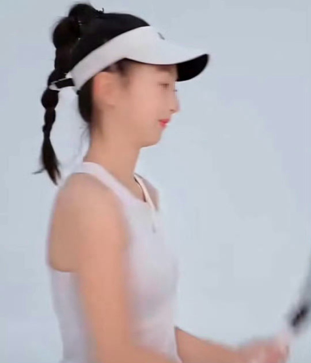 森碟下巴后缩改善了很多我咧个豆，这是去整容了吧森碟｜​​​
