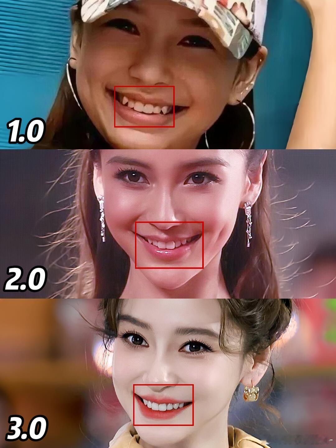 Angelababy现在对比出来看，除了牙变了，就是脸瘦了，其他的真的都没变