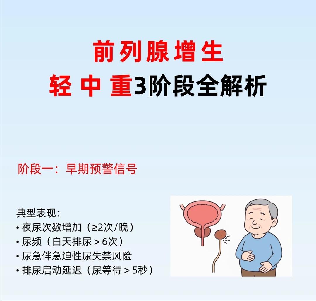 别等严重才发现！前列腺增生3个阶段