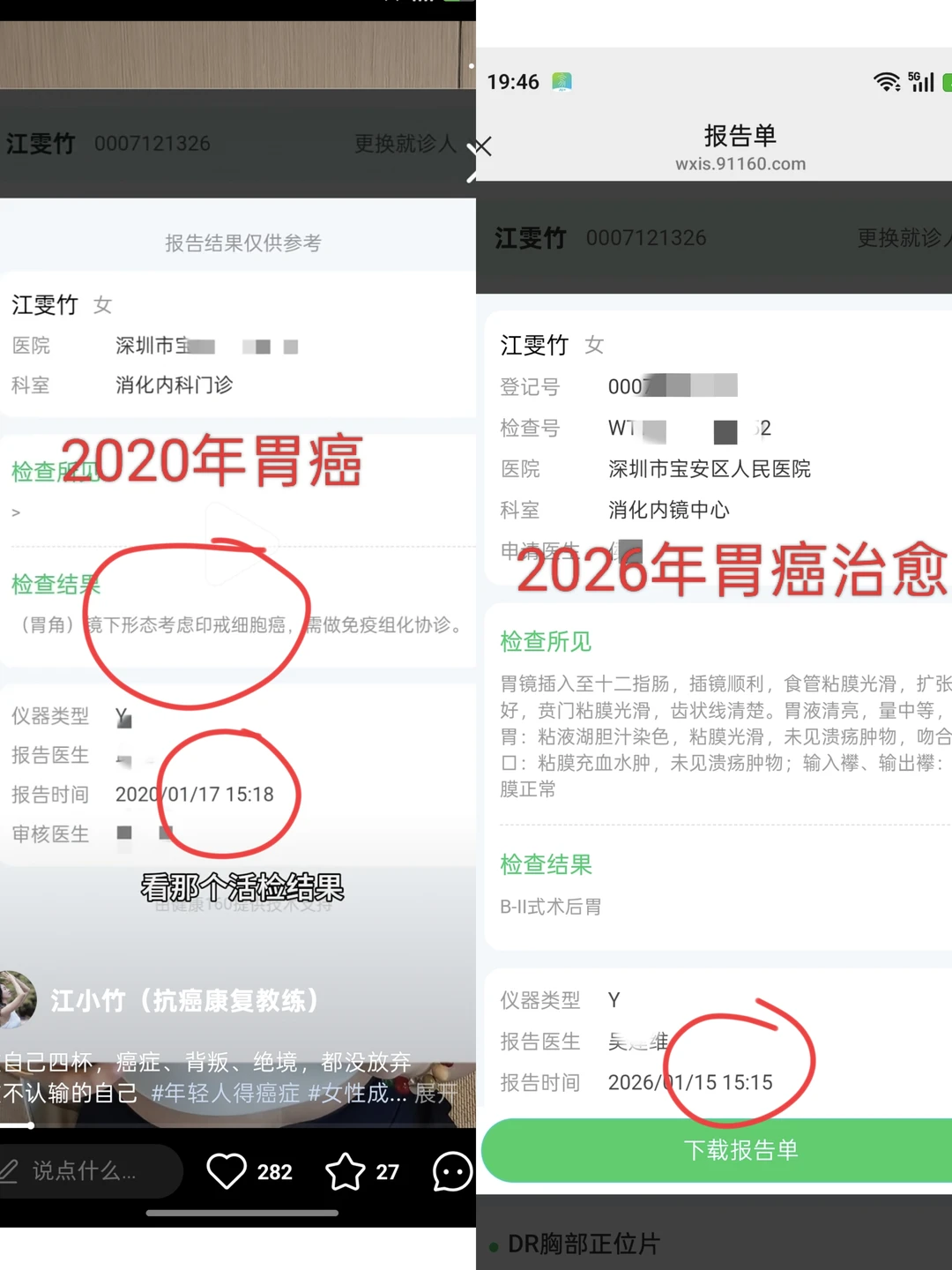 胃癌，从这里开始，从这里结束！