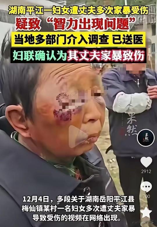 湖南平江，一位年仅四十多岁的妇女，被丈夫的暴行摧残得形同六十多岁的老人。她的遭遇