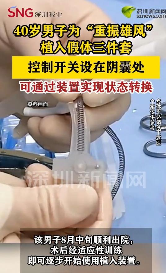 “开眼了！”9月4日报道，广东深圳，一40岁男子想“变强”，强烈要求：植入假体三