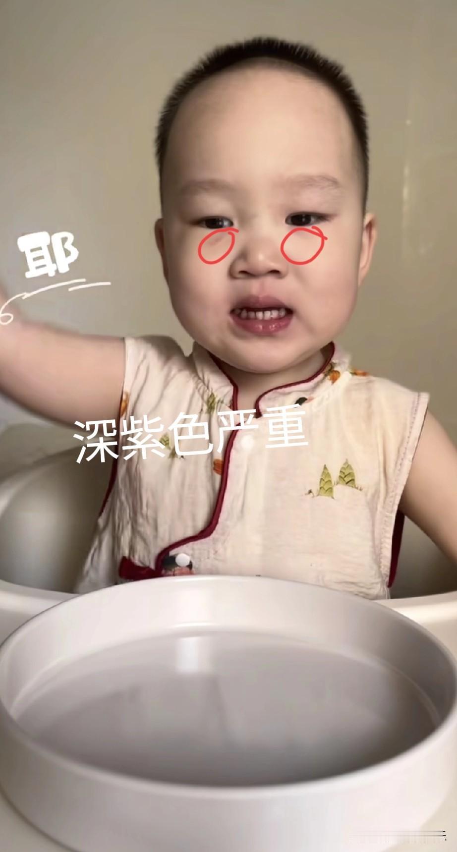 我外甥女已经查出了问题，在此好心提醒一下米乐父母，赶紧带孩子也去检查一下，别
