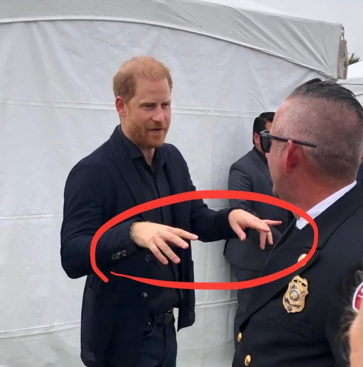 哈里王子怎么了？？如果查尔斯把他的大手指遗传给他，这可能是一个很棒的遗传