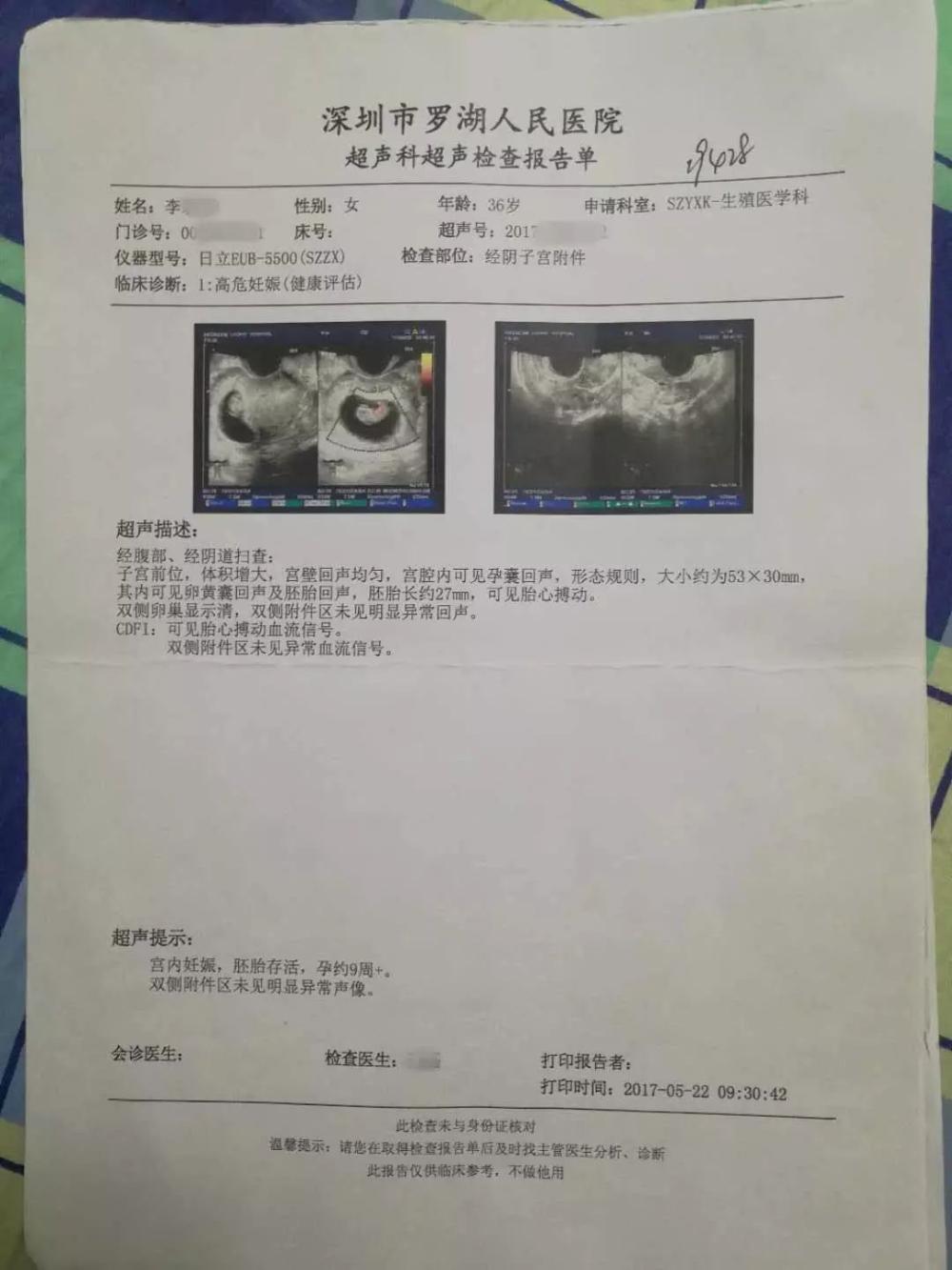 深圳高龄产妇顺产时胎儿死亡 到底是谁拒绝了剖宫产