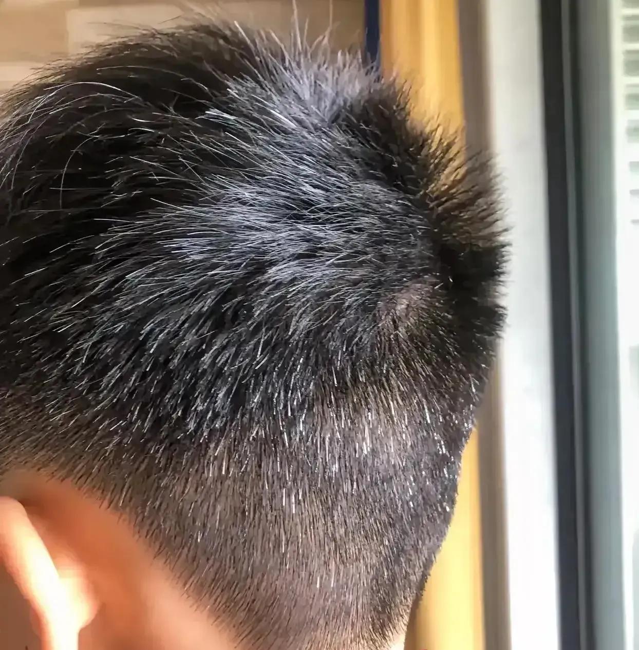 没想到洗了十几年的头发，最后是这样的结果！在个人仪表上，我特别爱干净，几乎每天