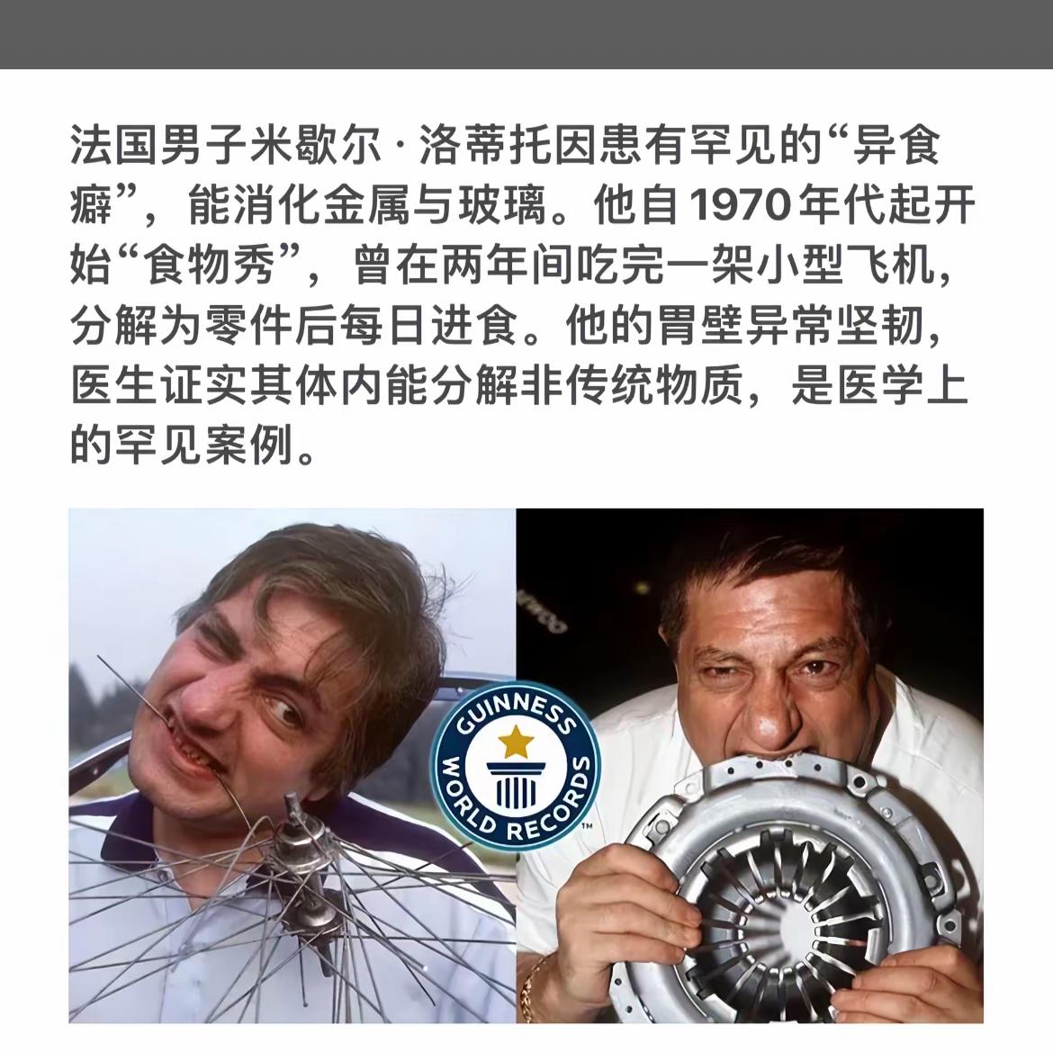 “异食癖男子挑战极限：吃下飞机零件！”📸🤢