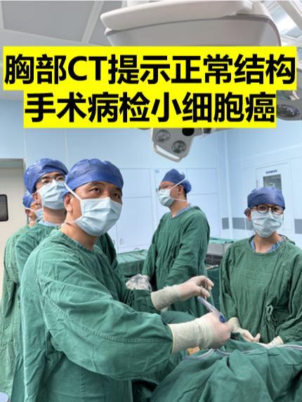 胸部CT提示淋巴结，手术病检小细胞肺癌。周二出肺癌肺结节门诊，来了一位...