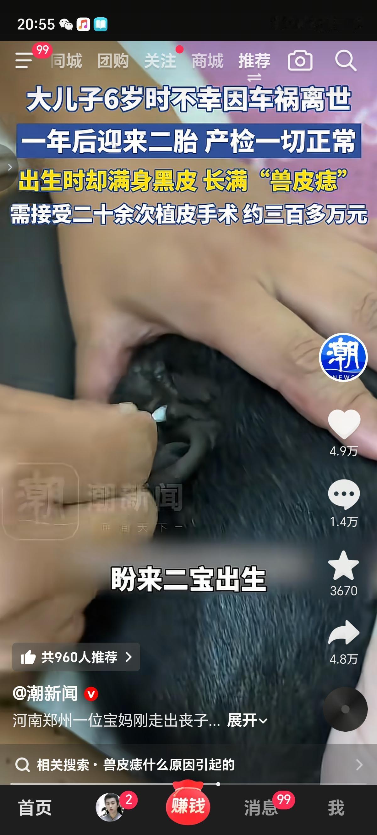 人怎么会生出满身黑皮的孩子呢？还叫啥“兽皮痣”，摸起来又粗糙，还长着黑毛。真是只