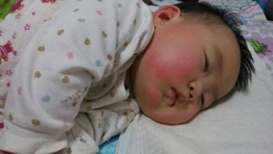 5个月宝宝差点窒息, 送去医院检查, 结果出来后, 妈妈后悔不已!