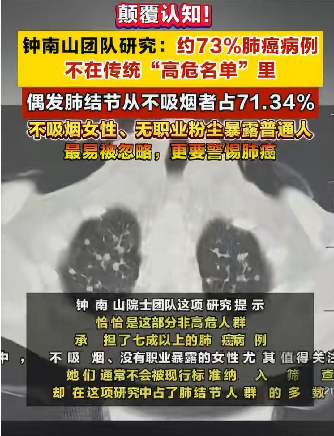 #钟南山团队发现肺结节发病新趋势#近几年的体检中，常常听到的是有了“肺结节”。问医生，医生回答：如今