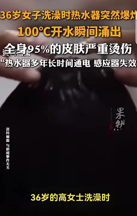 太吓人！洗澡时热水器突然爆炸，36岁女子全身95%烫伤，这场悲剧本可以完全避免！
