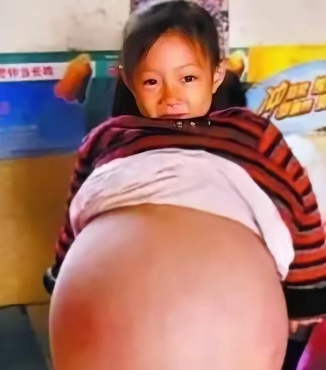山西一4岁小女孩，肚子异常鼓胀，大得像足月孕妇。多家医生轮番诊断，残酷预言她活不