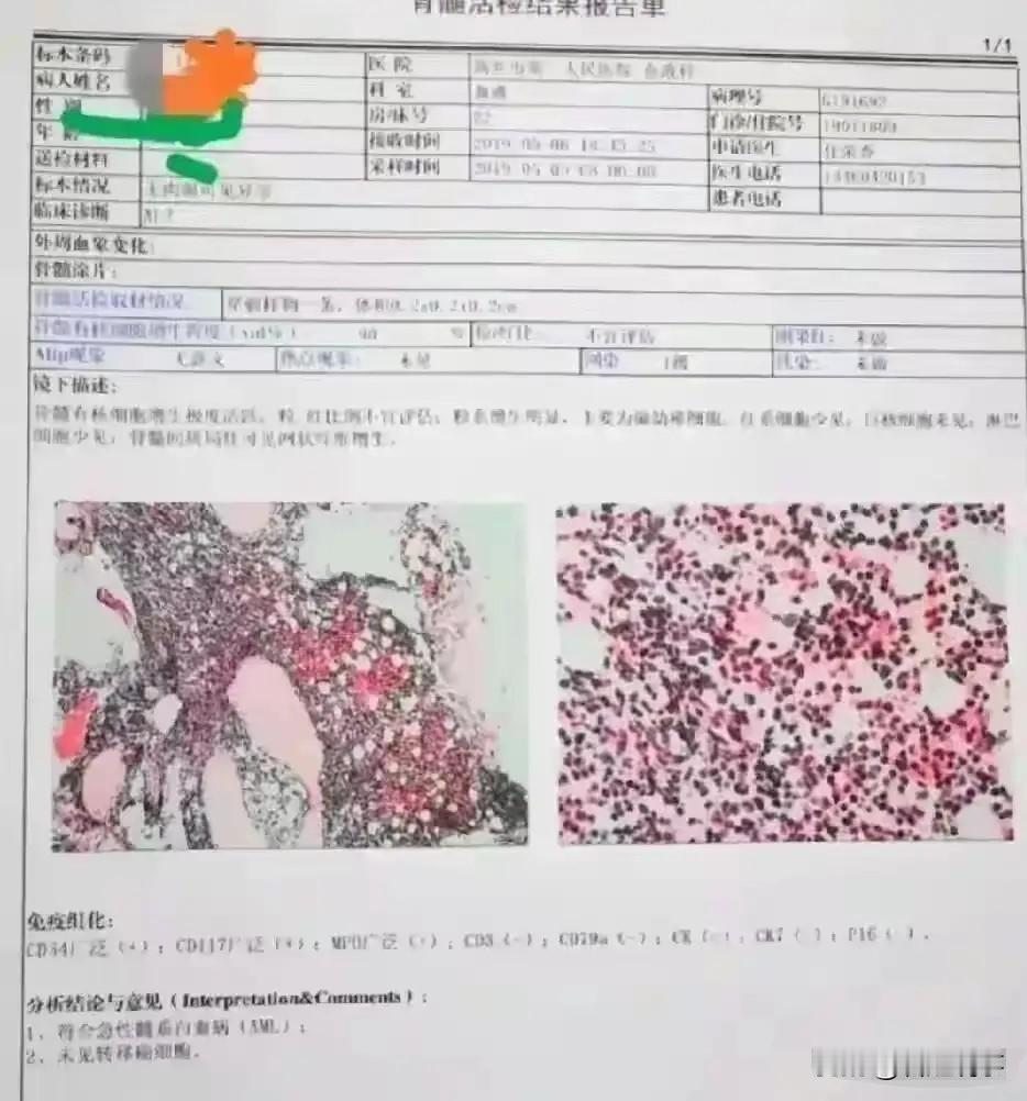 我得白血病七年了，我认识很多白血病病友，还在几个病友群里待过。截止目前，