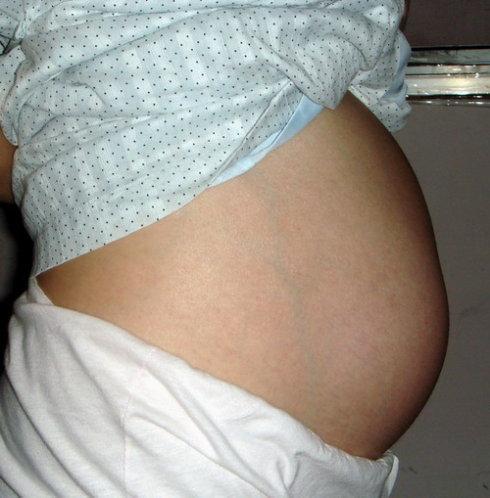 孕妇为生男孩偷吃“转胎药”, 看到孩子样子, 孕妇大呼: 处理掉!