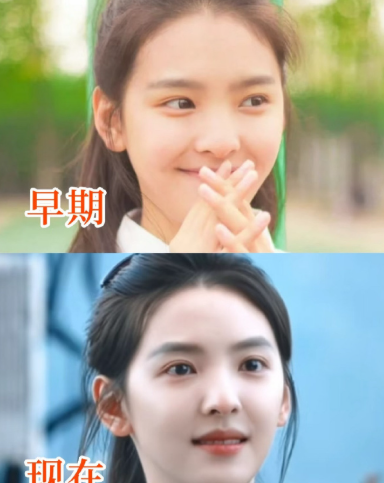 不是章若楠都有人说她整容？我印象中她是出了名的纯天然啊​​​