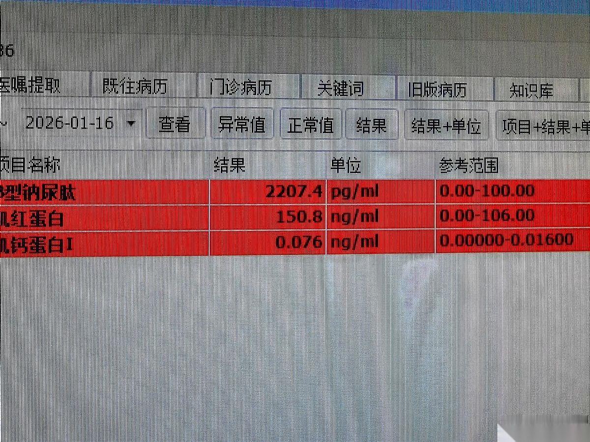 我跟你说，有时候当医生真挺无力的。血压150，血糖19，肌酐600多，心衰指标