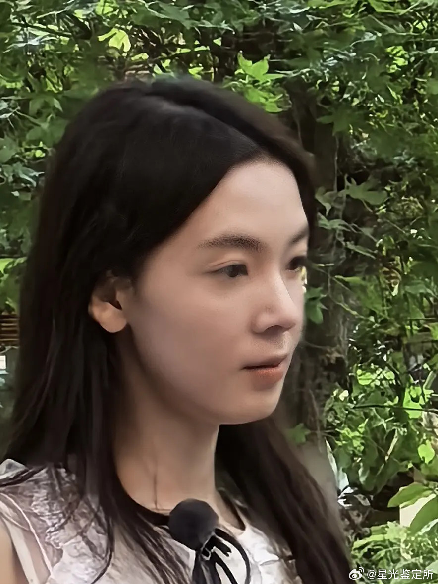 陈瑶刚有红的趋势，脸状态就不好了