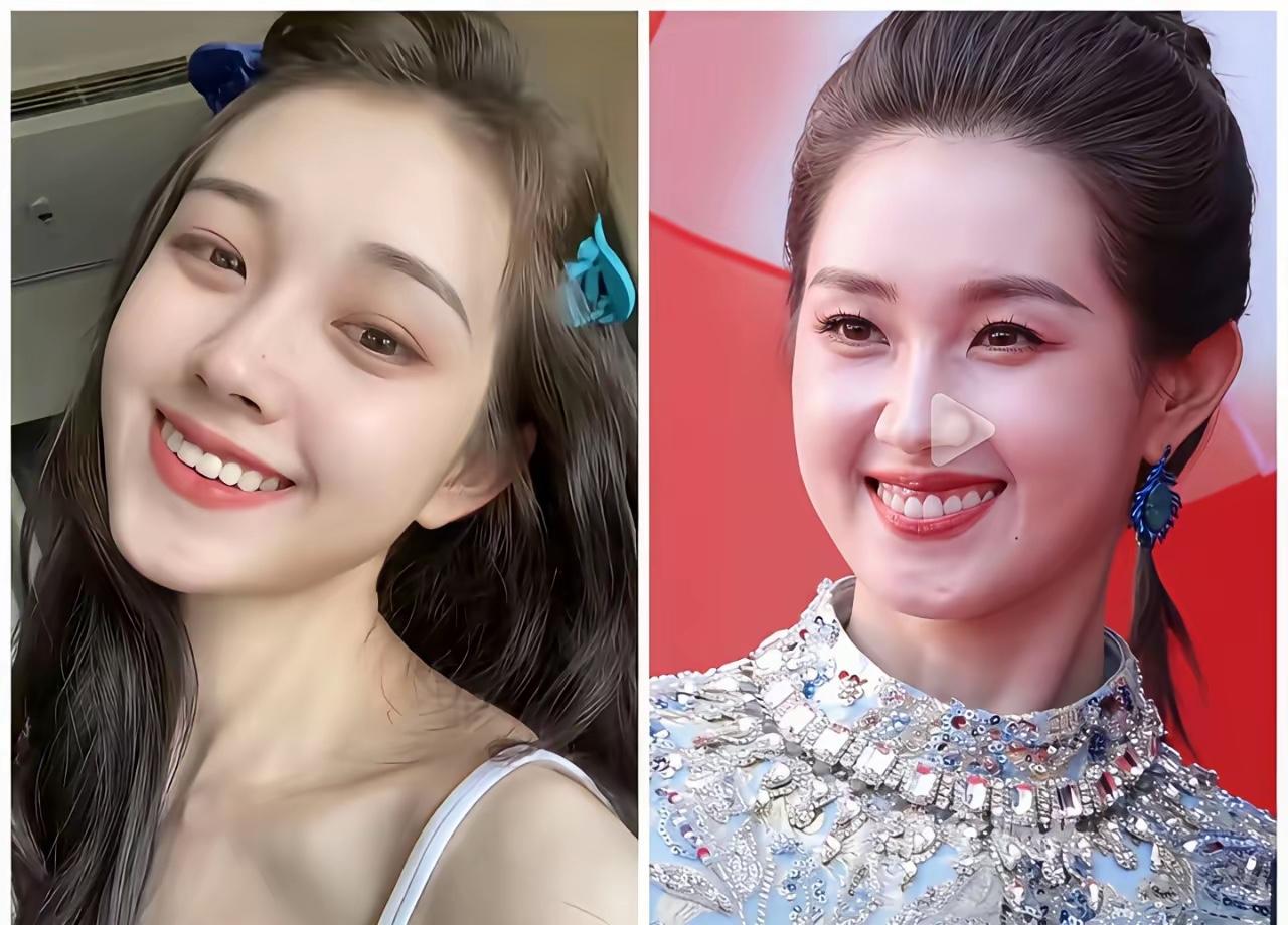 左边是郭宇欣23岁的时候右边是郭宇欣26岁发现了吗，郭宇欣23岁的时候，牙齿