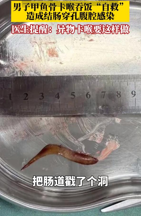 “悲剧还是发生了！”11月7日报道，浙江杭州，一男子吃甲鱼时，一根骨头卡在了喉咙