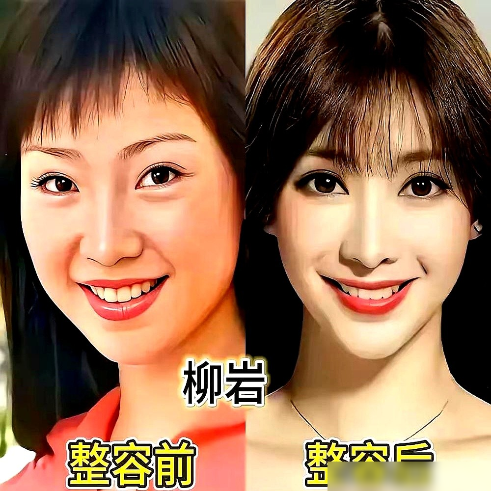 沈梦辰早年选秀录像被扒出来了，黑黄皮，大圆脸，塌鼻子，跟现在判若两人。网友拿着对比图骂她换头，她直接