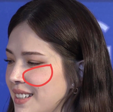 尽管脸上有很多斑点，但一点也不影响到她的气质，是女明星里比较真实的一个，大大方方