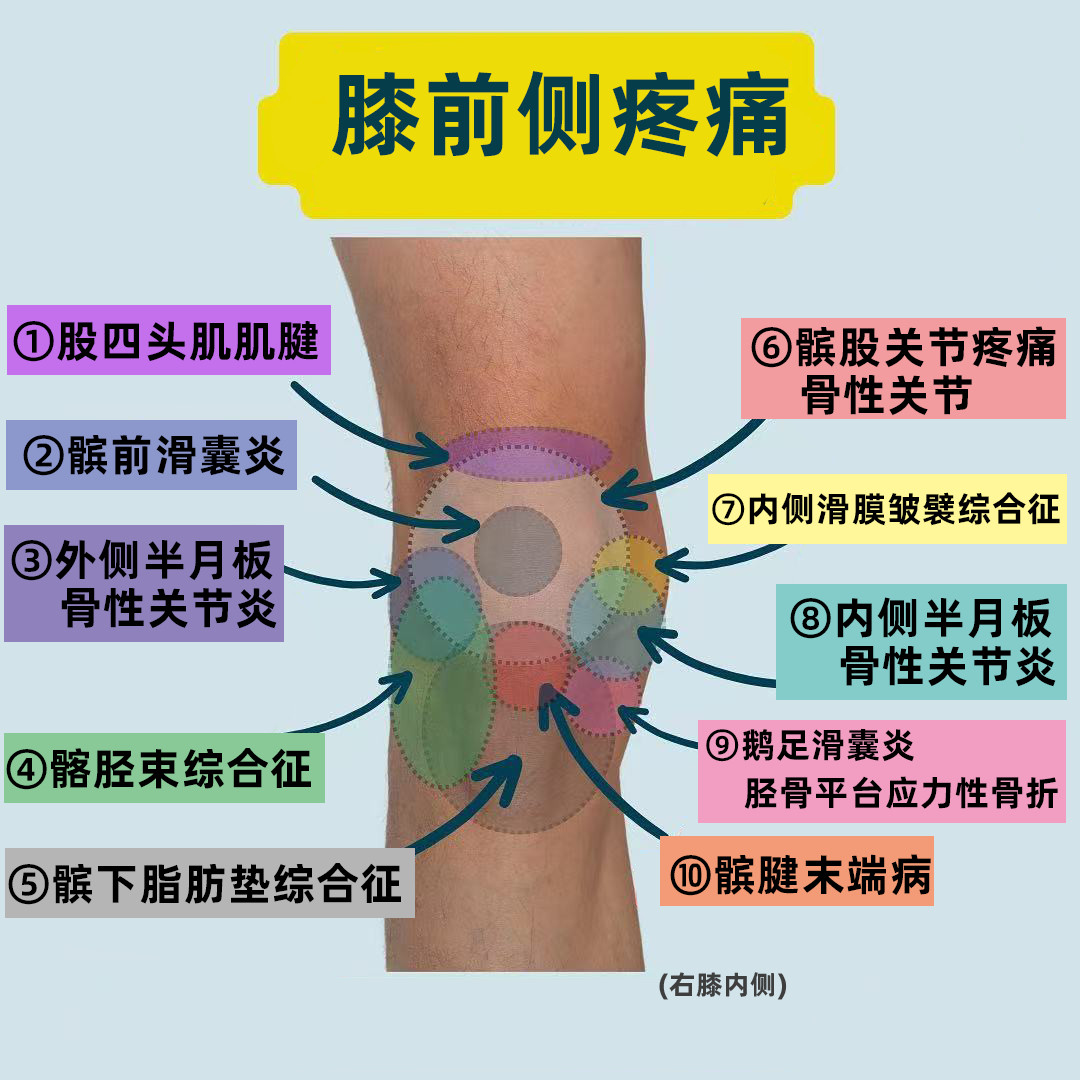 膝关节损伤总结贴——你的膝关节疼痛，不同的位置，可能是什么损伤👇🏻👇🏻