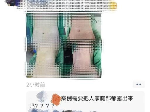 重庆一女子刷到医美朋友的朋友圈，腹部项目露出顾客胸部，乳头、乳晕都很清楚，一点遮