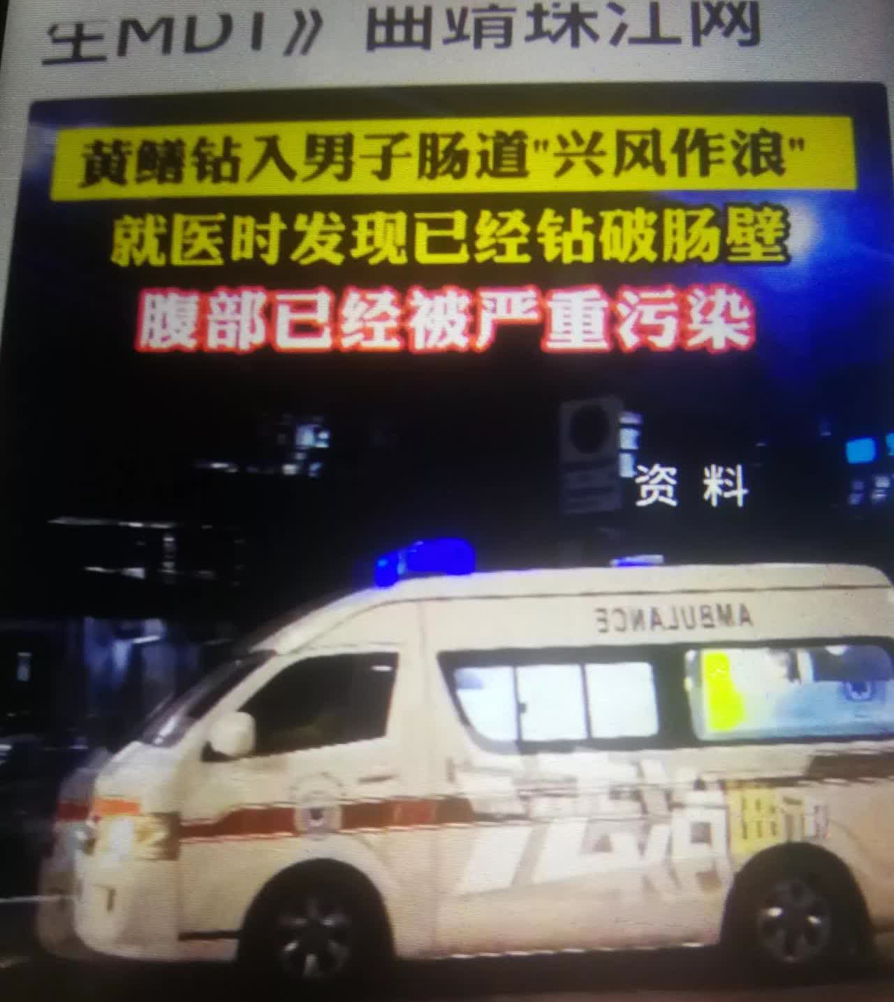简直是千古奇闻湖南一男子被一条30厘长的蟥蟮一直从缸门冲入体内，而且还钻破了