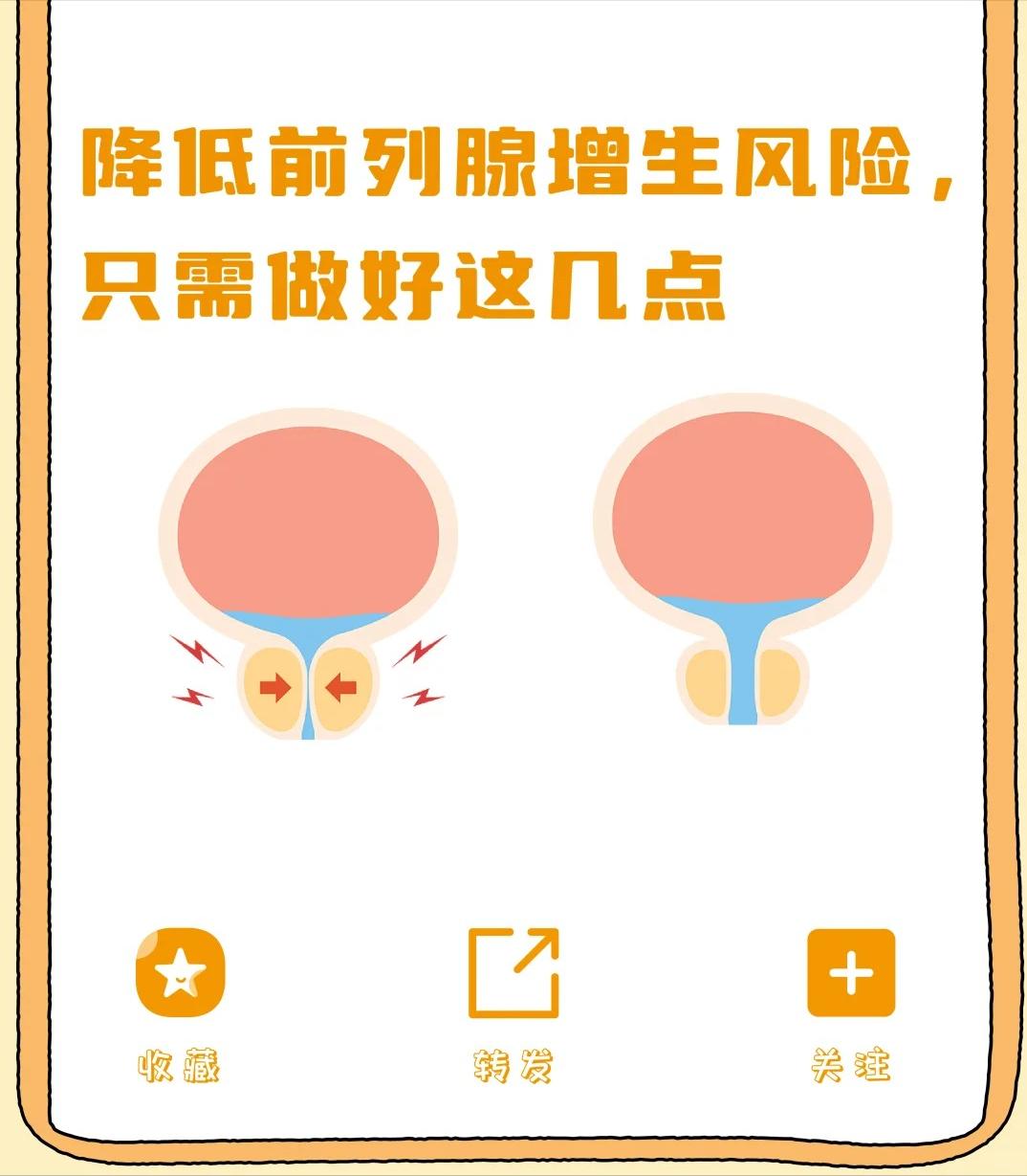 降低前列腺增生风险，只需做好这几点！