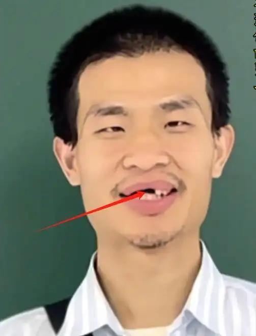伴随韦东奕涨粉上热搜的，还有他已经缺失半边的前排牙齿。在这一点上，我是有绝对发言