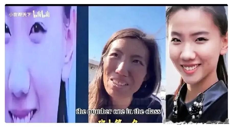 有人说美国街头流浪的女子，很像13年北京舞蹈学院，失踪的邢睿，长相上确实像似度