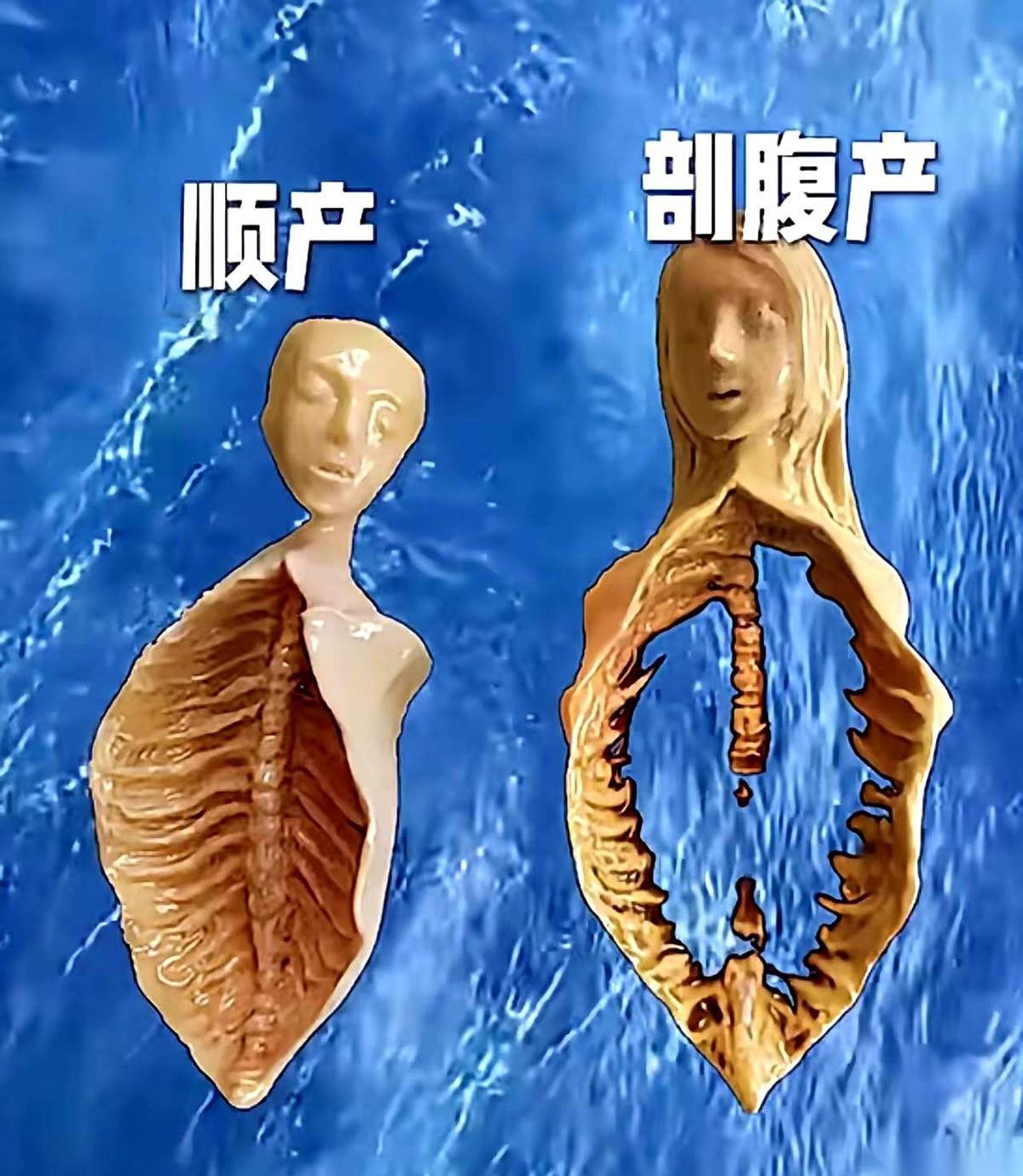 我跟你说个事儿，剖腹产这东西，很多时候根本不是给女人选的。说白了，就是给那些在