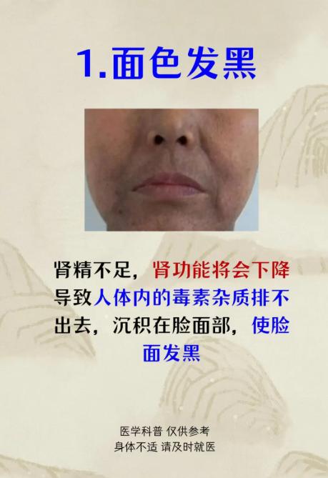 男士长期损耗精气，身体会有这些表现，看你中了几条？