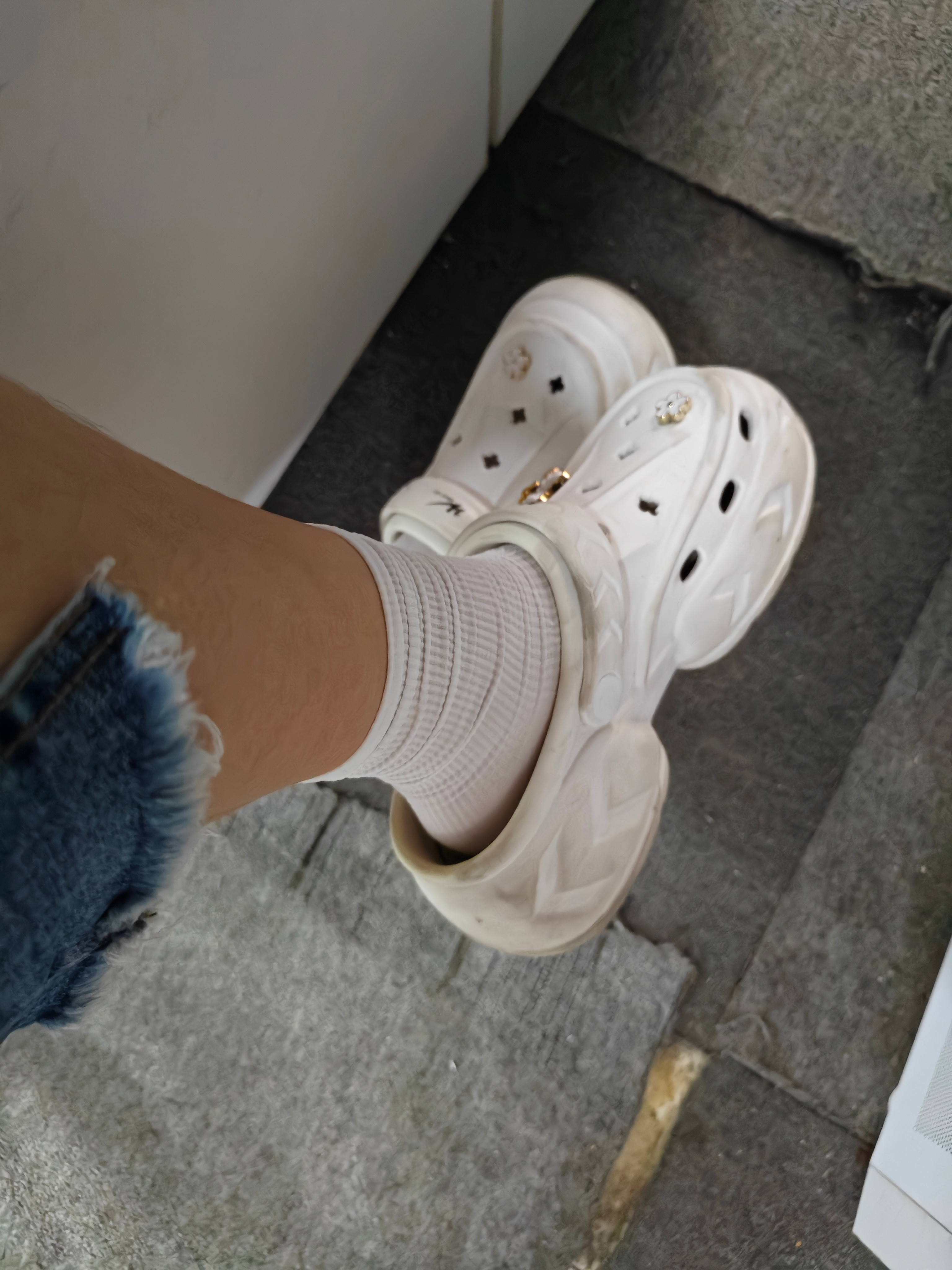 洞洞鞋真菌感染穿袜子、穿袜子、穿袜子！​​​