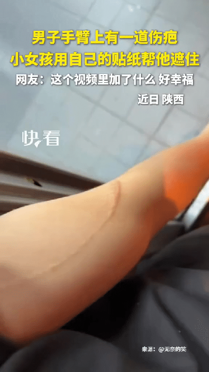 “看哭了!”陕西，一个男子手臂上有一道超长的伤疤，一个小女孩看见了，本以为女孩会