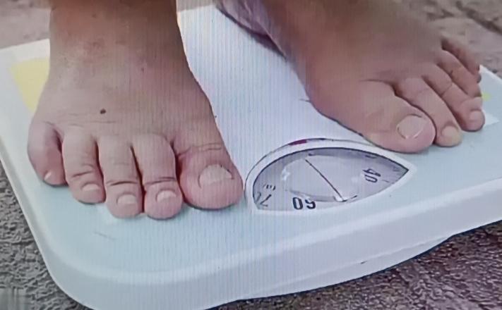 得了糖尿病，忌口这事不能马虎。糖尿病可怕的不是血糖高，而是并发症，像眼睛模糊、肾