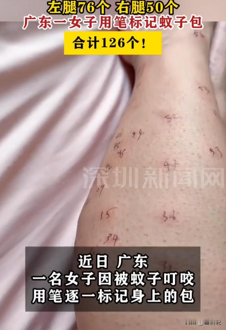 这是个狠人！广东一名女子夜间睡觉忘了关窗，屋内涌入大量蚊子，睡醒后双腿布满蚊虫叮