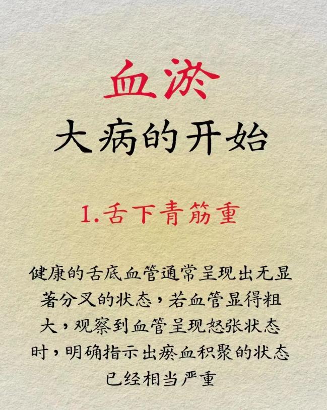 血瘀体质，是身体发出的预警信号