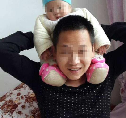 2岁女儿身患白癜风, 小美女变小丑女, 都是爸爸惹的祸