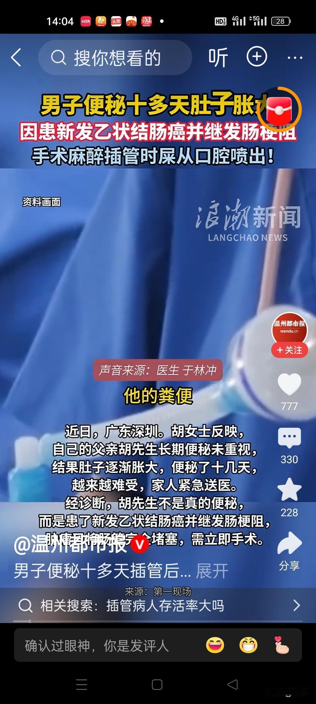 最近“一男子便秘十多天后粪便从口腔喷出”的话题冲上热搜。七十多岁的胡先生起初以为