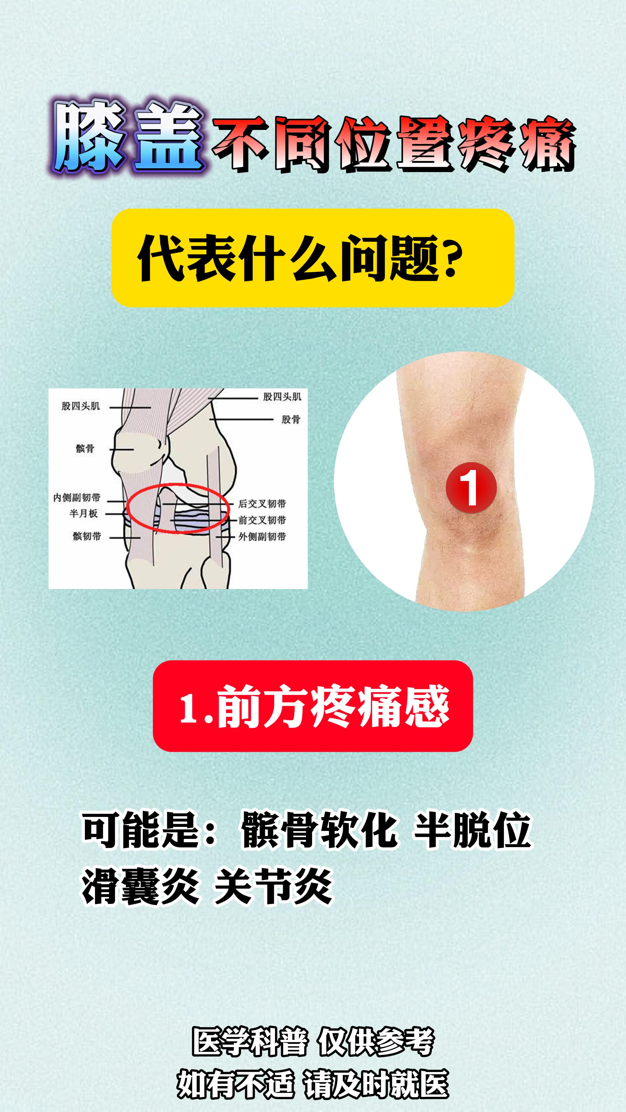 膝盖不同位置疼痛代表什么问题。
