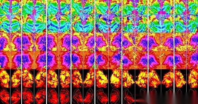 以色列魏茨曼科学研究所的米哈尔·伊拉尼团队，用人工智能工具分析八名受试者的脑部扫描数据，直接复原出了