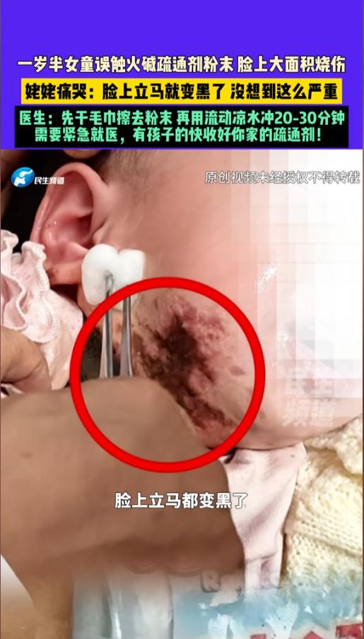 “悲剧还是发生了！”近日，河南郑州，一位宝妈永安管道疏通剂后，看着鞋柜高度还行，