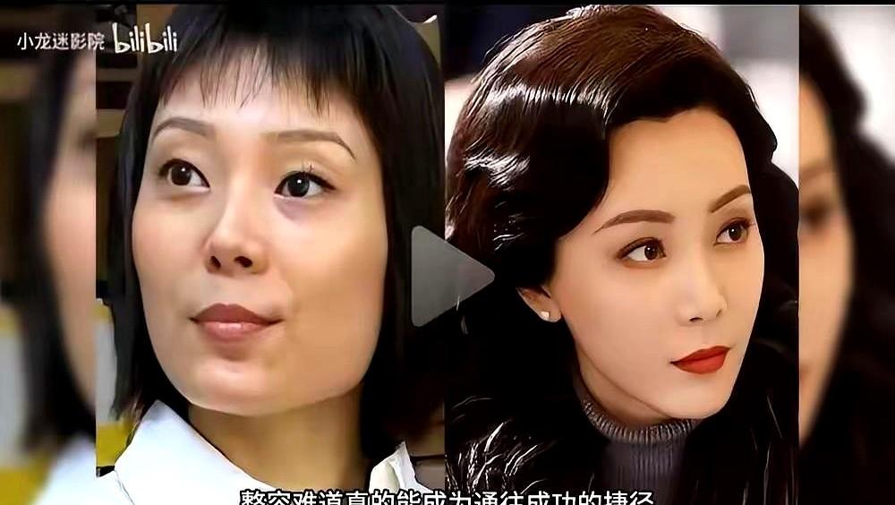 看到陈数那几张对比照，突然就理解了什么叫“有钱才有资格变好看”。从凸嘴、大腮帮