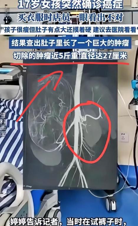 “幸亏发现了！”广东17岁女孩和妈妈一起逛街买衣服，在试裤子的时候，老板娘发